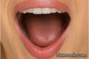 غلیظ شدن بزاق دهان ، بزاق دهان