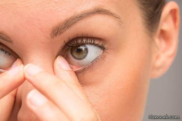 علت ضعیف شدن چشم 