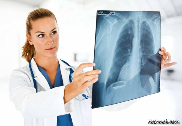 علائم آبسه ریه