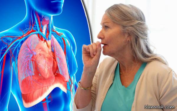 بیماری آبسه ریه