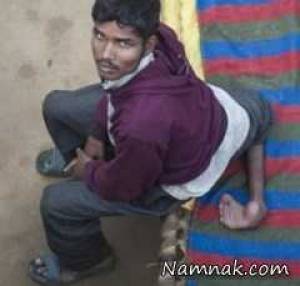 مرد 4 پا ، عکس انسان 4 پا
