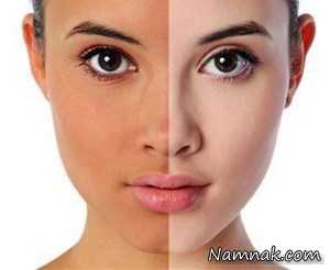 برنزه كردن ، انواع برنزه کننده