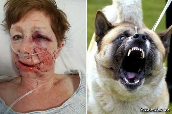 حمله سگ به یک زن