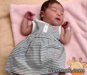 مرگ از گرسنگی ، عکس نوزاد 5 ماهه که از گرسنگی مرد