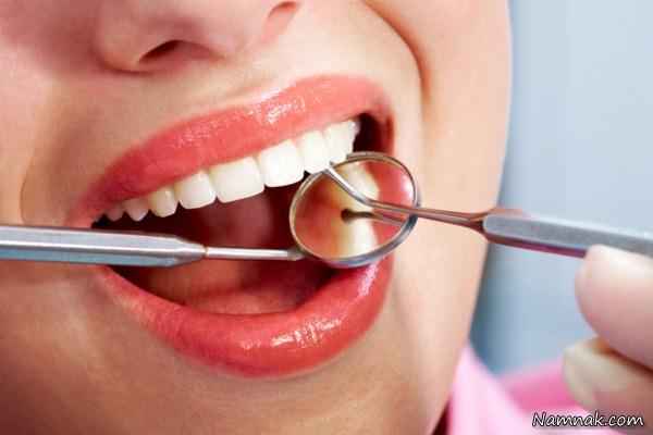 از بین بردن جرم دندان