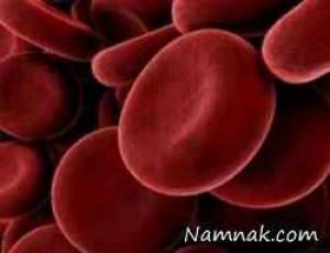 لخته شدن خون در پا نشانه چیست؟