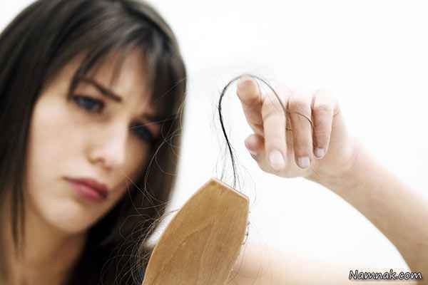 علت ریزش مو ، ریزش مو ، ریزش مو در زنان