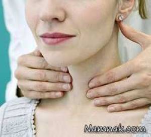 تنظیم تیروئید