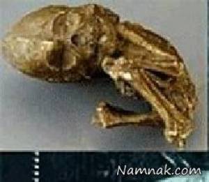 فسیل نوزاد ، خارج شدن فسیل کودک 35 ساله از شکم زن 73 ساله