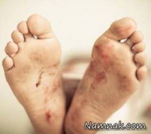 زنده شدن ، دوباره زنده شدن مرده قبل از دفن