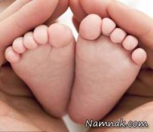 مادر نوزاد ، تورنیکه مویین روی پای نوزاد