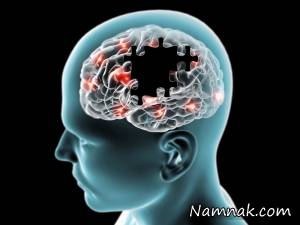 داروی پارکینسون ، قرص سافینامید پارکیسنون