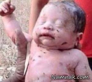 مادر نوزاد ، نجات نوزاد زنده به گور شده