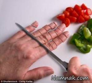 قطع انگشت دست ، کمک های اولیه قطع شدن انگشت