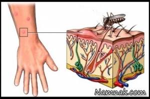 تب کنگو ، پیشگیری از تب کریمه کنگو