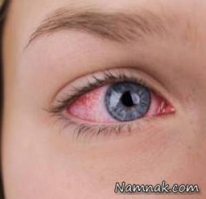 چشم کور ، ترکیدن ترقه