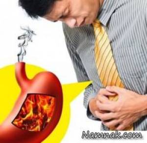 تغذیه رفلاکس معده