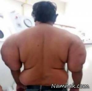 غواص ، بیماری عجیب و غریب