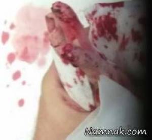 خوراک زنده ، زنده زنده خوردن انسان
