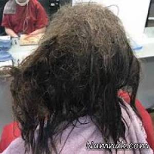 دختری که از موهایش شپش می چکد! + تصاویر 1