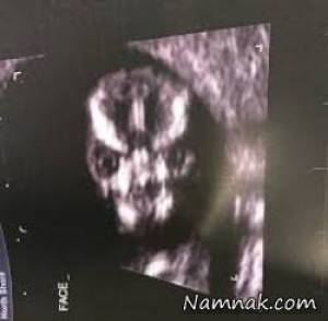 وحشت مادر از عکس سونوگرافی جنین داخل شکمش + عکس 1