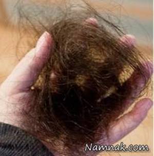 ریزش موی ناگهانی ، stop hair loss