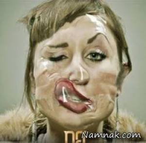 بوتاکس قلابی ، عکس عوارض بوتاکس