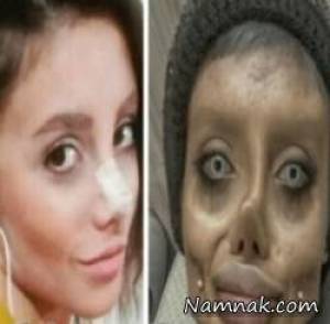 سحر تبر قبل عمل ، عکس های دختر ایرانی شبیه انجلینا جولی