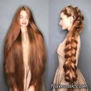 ریزش مو کچل شدن ، راپونزل واقعی