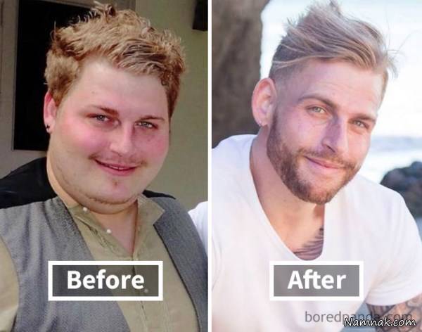 قبل و بعد لاغری