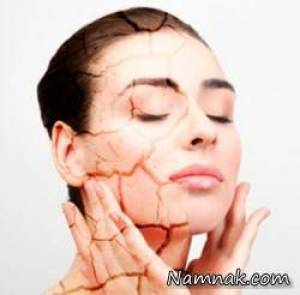 لایه بردار پوست