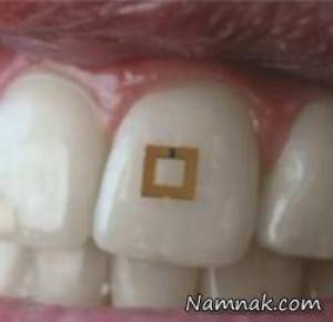 حسگر ضد چاقی ، اختراع جدید برای کاهش وزن
