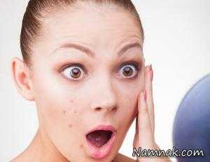 جوش صورت ، جوش های عفونی صورت