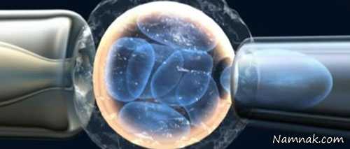تشخیص بیش از لانه گزینی جنین (PGD) ، میکرواینجکشن یا تزریق اسپرم داخل تخمک icsi ، لقاح خارجی رحمی