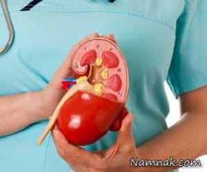 پیوند کلیه ، پیوند کلیه چیست