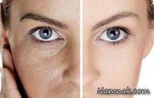 چرب شدن پوست صورت ، علل چرب شدن پوست صورت