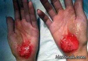 تنبیه معلم ، تنبیه دانش آموزان