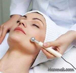 لیزر موهای زائد ، لیزر موهای زائد صورت
