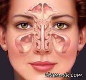 گرفتگی سینوس ها ، چای گوجه فرنگی