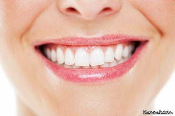 سفیدی دندان ، خمیر سفید کننده دندان ، سفید کننده دندان قوی
