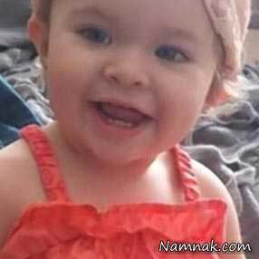 دختربچه 14 ماهه بعد از پرکردن دندان جانش را از دست داد
