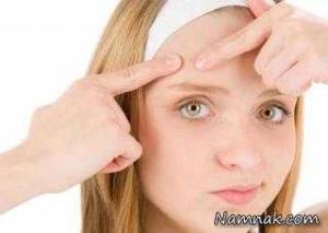 جوش زدن صورت