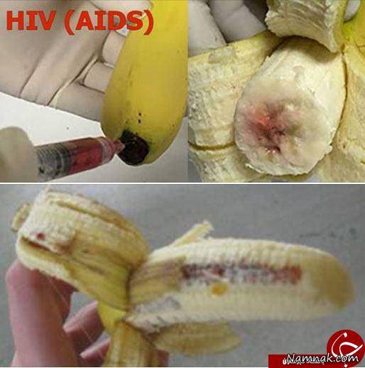 موز ایدز