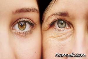 چین و چروک صورت ، رفع چین و چروک پیشانی