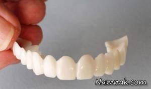 روکش دندان ، قصور پزشکی