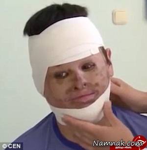 مرد بدون چهره ، مرد بدون چهره