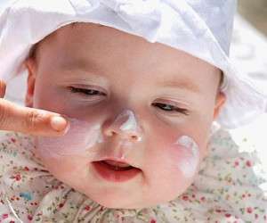 آفتاب سوختگی کودک ، روش درمان آفتاب سوختگی کودک