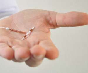 بارداری ، بارداری با IUD