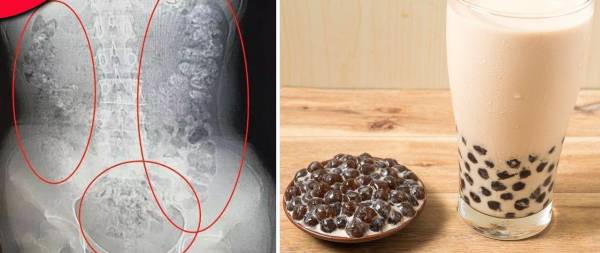حادثه دردناک برای دختر چایی خور - سرگرمی