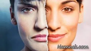 اختلال مانیا